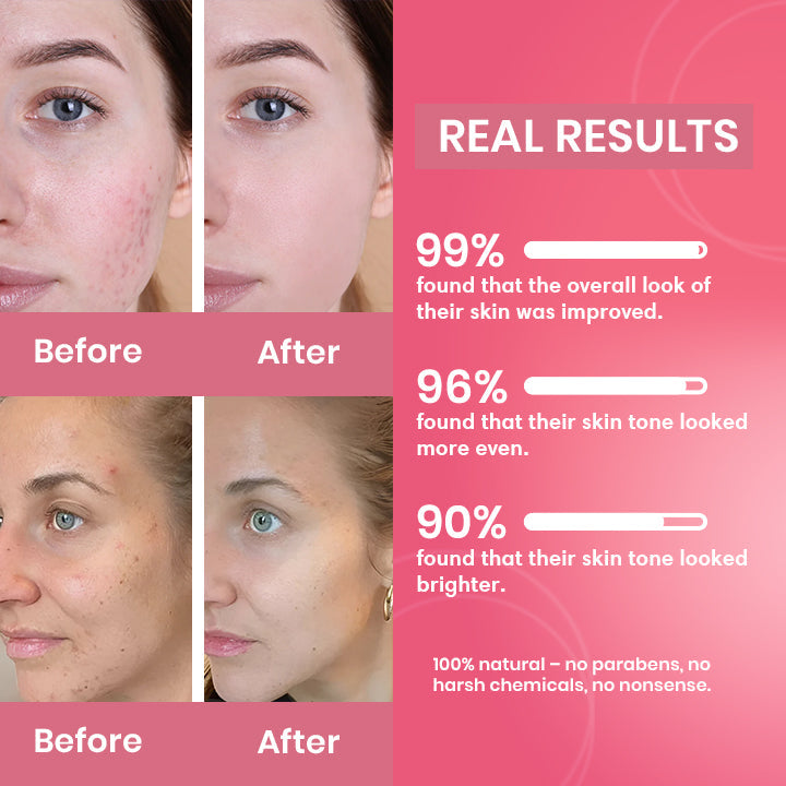 Turmeric & Kojic Acid Pads – Skin Brightening & Acne Treatment